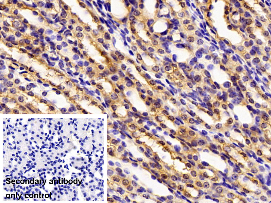 Polyclonal Antibody to Pyruvate kinase isozymes M2 (PKM2)