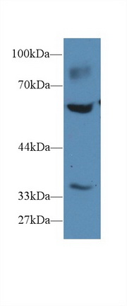 Polyclonal Antibody to Pyruvate kinase isozymes M2 (PKM2)