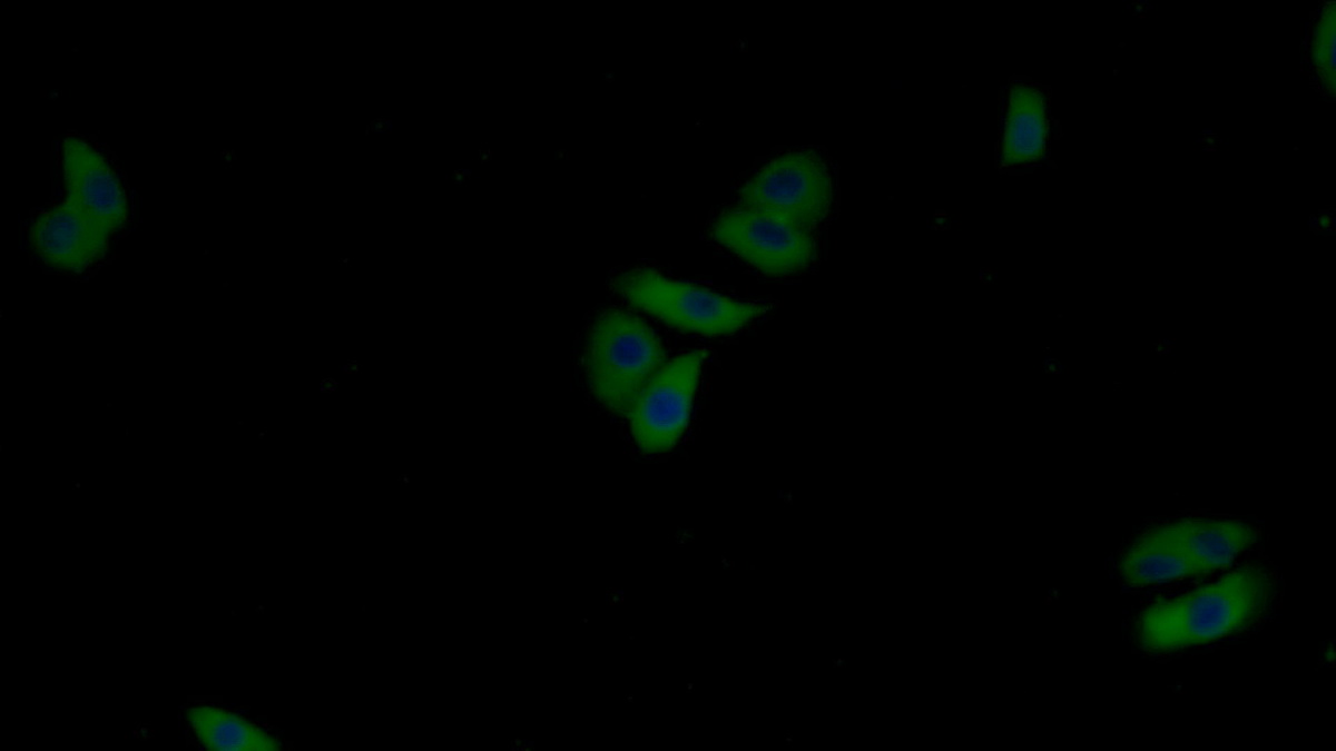 Polyclonal Antibody to Pyruvate kinase isozymes M2 (PKM2)