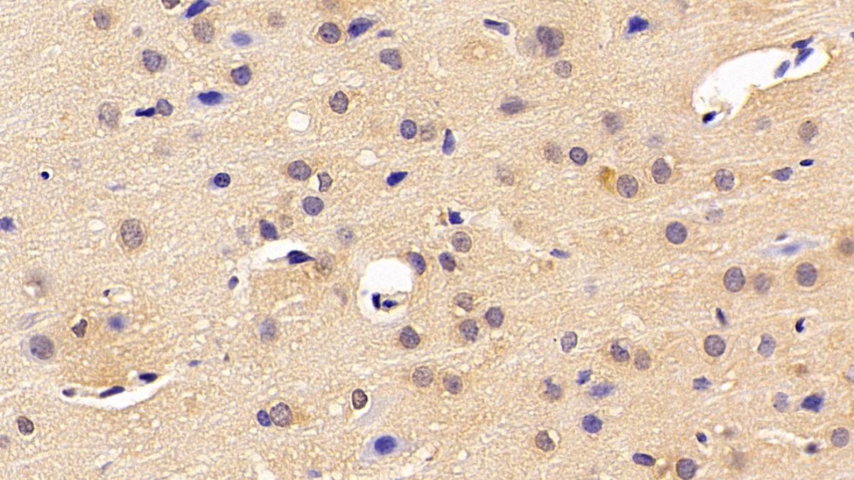 Polyclonal Antibody to Pyruvate kinase isozymes M2 (PKM2)