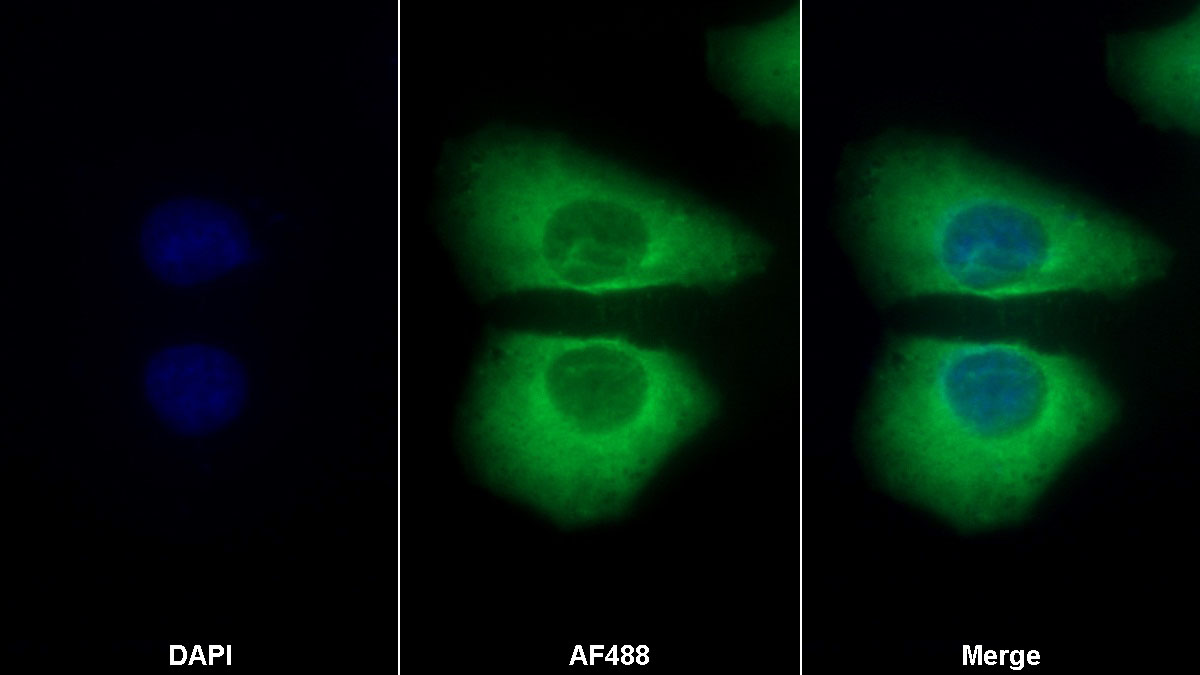 Polyclonal Antibody to Pyruvate kinase isozymes M2 (PKM2)