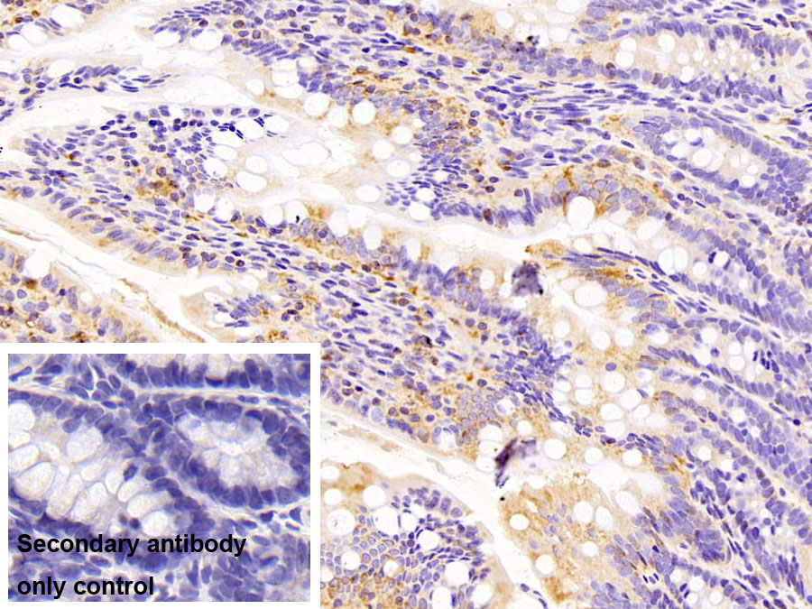 Polyclonal Antibody to Pyruvate kinase isozymes M2 (PKM2)