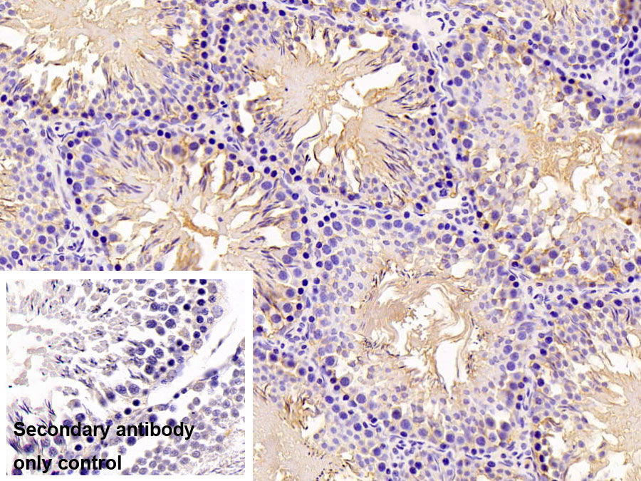 Polyclonal Antibody to Pyruvate kinase isozymes M2 (PKM2)