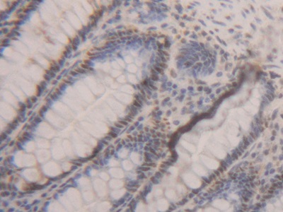 Polyclonal Antibody to Proliferating Cell Nuclear Antigen (PCNA)