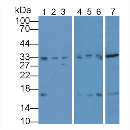 Polyclonal Antibody to Proliferating Cell Nuclear Antigen (PCNA)