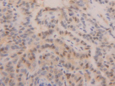 Polyclonal Antibody to Proliferating Cell Nuclear Antigen (PCNA)