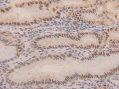 Polyclonal Antibody to Proliferating Cell Nuclear Antigen (PCNA)