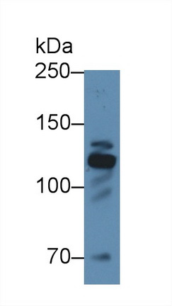 Polyclonal Antibody to Fibrillin 1 (FBN1)