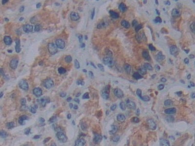 Polyclonal Antibody to Fibrillin 1 (FBN1)