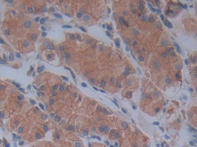 Polyclonal Antibody to Fibrillin 1 (FBN1)