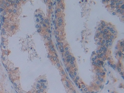 Polyclonal Antibody to Fibrillin 1 (FBN1)