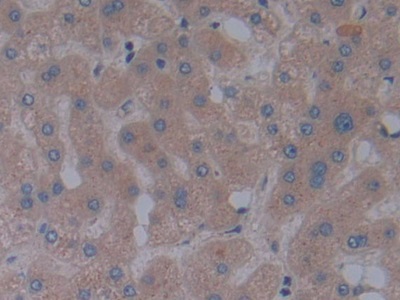 Polyclonal Antibody to Fibrillin 1 (FBN1)