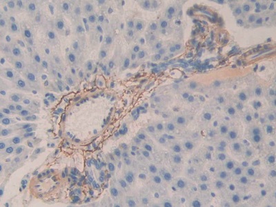 Polyclonal Antibody to Fibrillin 1 (FBN1)