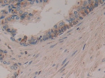 Polyclonal Antibody to Cytochrome C (CYCS)