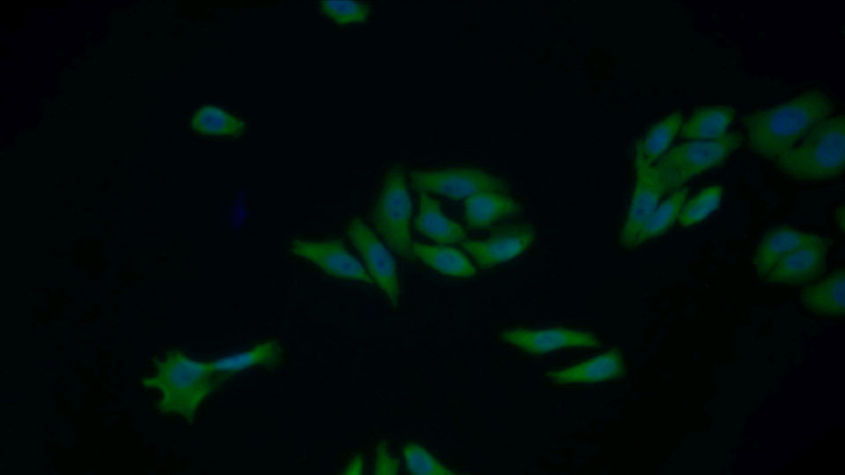 Polyclonal Antibody to Cytochrome C (CYCS)