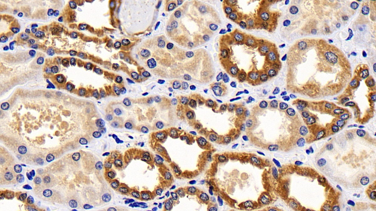 Polyclonal Antibody to Cytochrome C (CYCS)