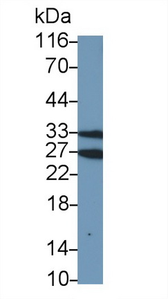 Polyclonal Antibody to Granzyme A (GZMA)