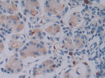 Polyclonal Antibody to Granzyme B (GZMB)