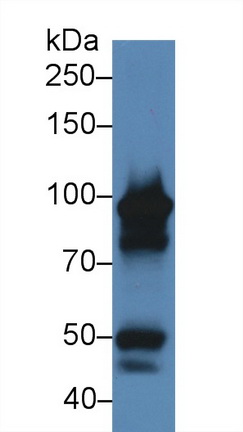 Polyclonal Antibody to Myeloperoxidase (MPO)