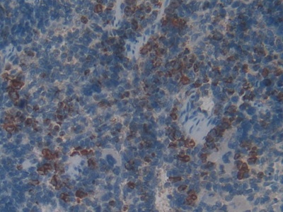 Polyclonal Antibody to Myeloperoxidase (MPO)