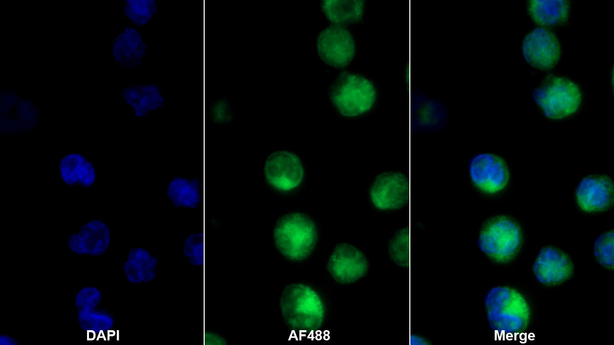 Polyclonal Antibody to Myeloperoxidase (MPO)