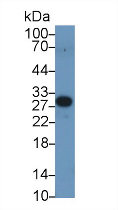 Polyclonal Antibody to Peroxisomal Biogenesis Factor 2 (PEX2)