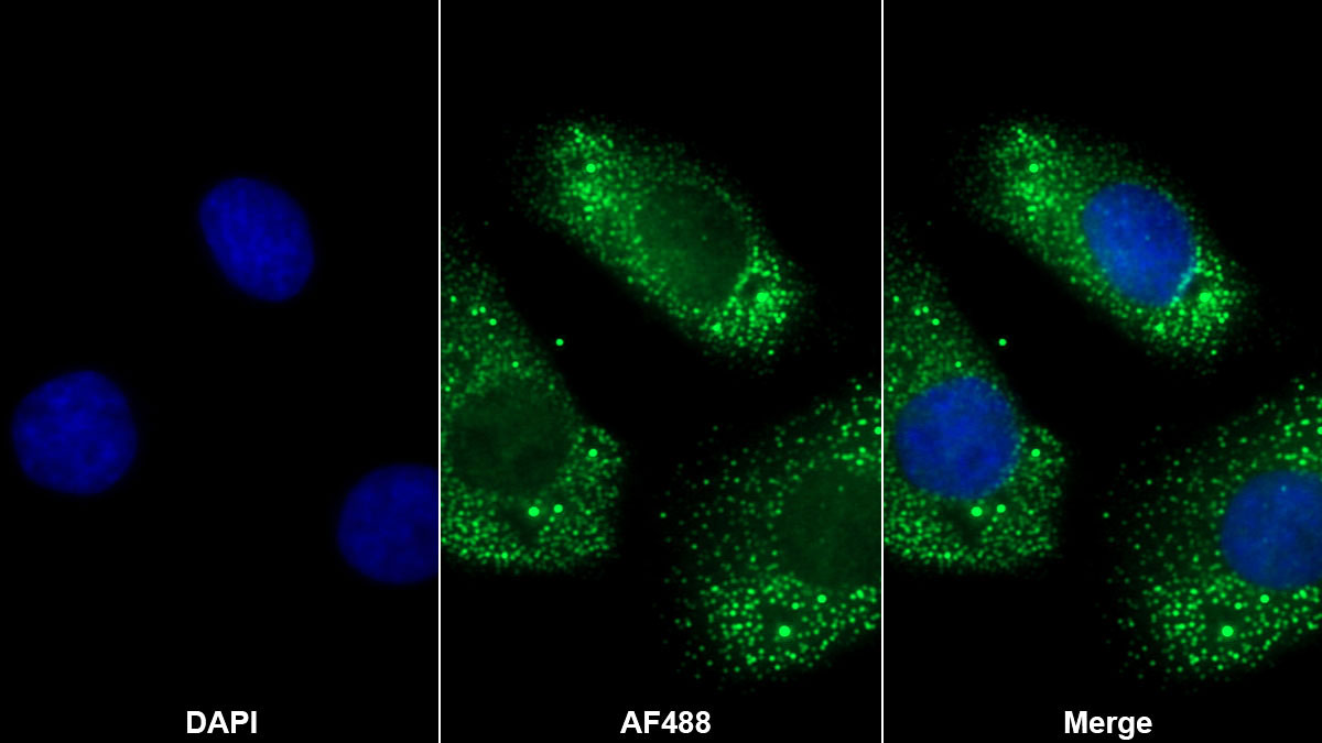 Polyclonal Antibody to Apolipoprotein B100 (APOB100)