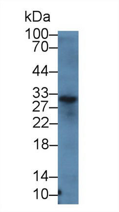 Polyclonal Antibody to Adiponectin (ADPN)