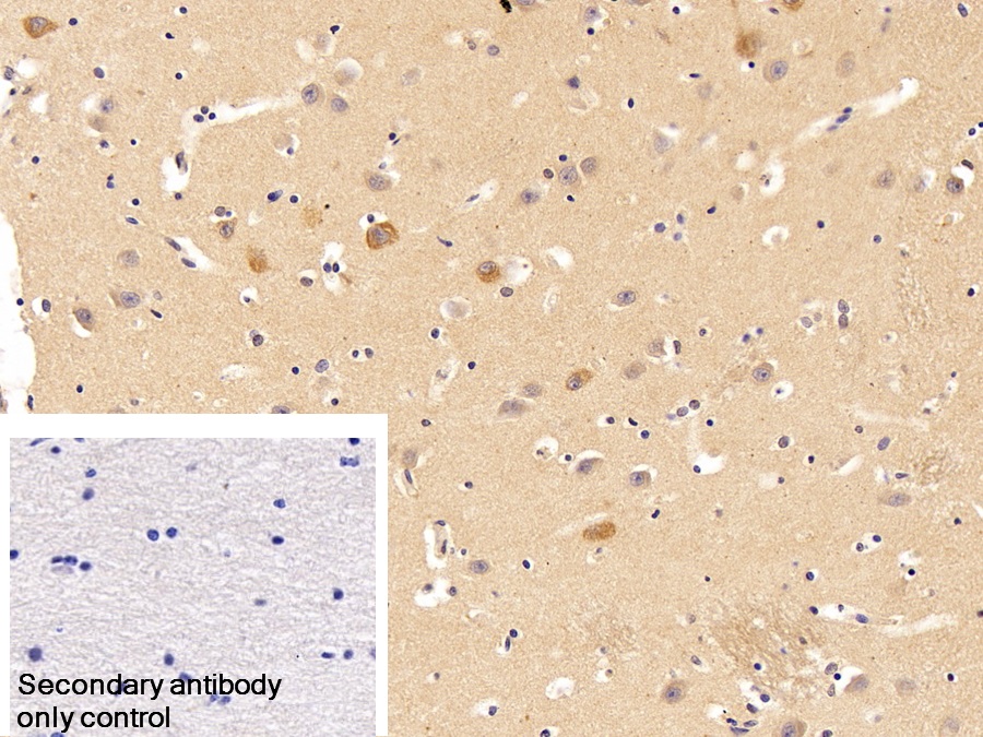 Polyclonal Antibody to Adiponectin (ADPN)