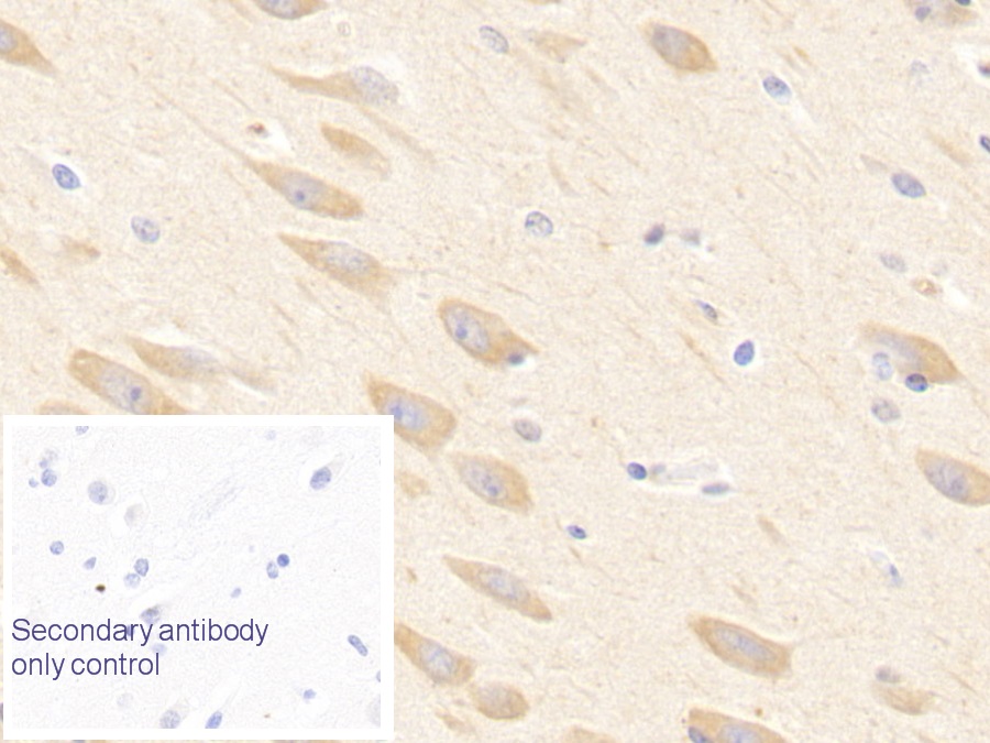 Polyclonal Antibody to Adiponectin (ADPN)