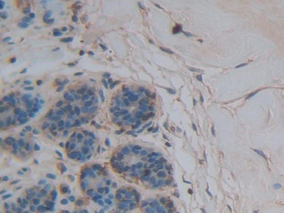 Polyclonal Antibody to Thrombospondin 1 (THBS1)