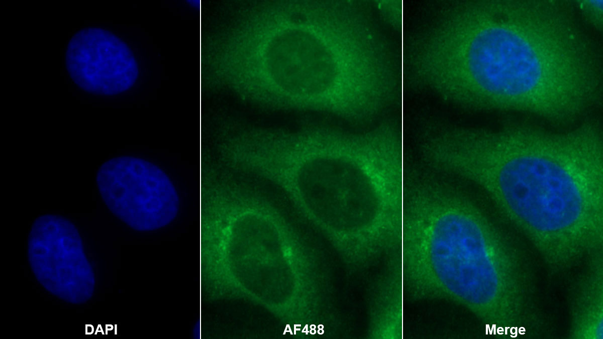 Polyclonal Antibody to Thrombospondin 1 (THBS1)