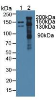 Polyclonal Antibody to Thrombospondin 1 (THBS1)