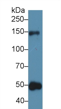 Polyclonal Antibody to Thrombospondin 1 (THBS1)