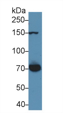 Polyclonal Antibody to Thrombospondin 1 (THBS1)