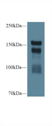 Polyclonal Antibody to Thrombospondin 1 (THBS1)