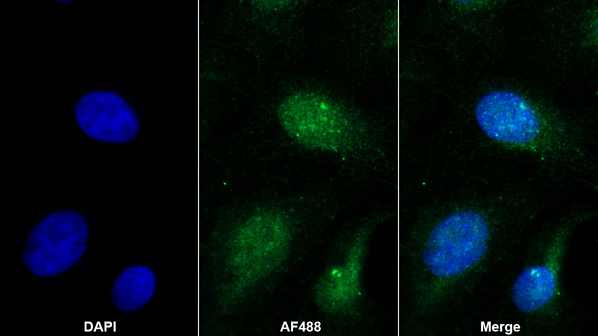 Polyclonal Antibody to Glutathione S Transferase Theta 2 (GSTt2)