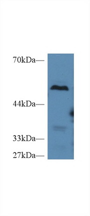 Polyclonal Antibody to Carboxypeptidase B2 (CPB2)