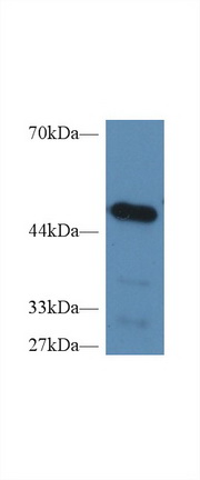 Polyclonal Antibody to Carboxypeptidase B2 (CPB2)