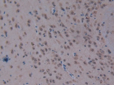 Polyclonal Antibody to Carboxypeptidase B2 (CPB2)