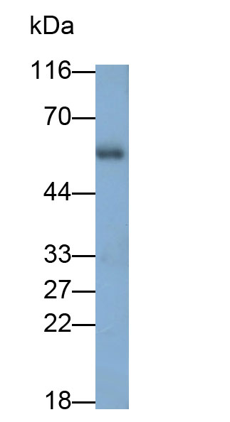 Polyclonal Antibody to Carboxypeptidase B2 (CPB2)