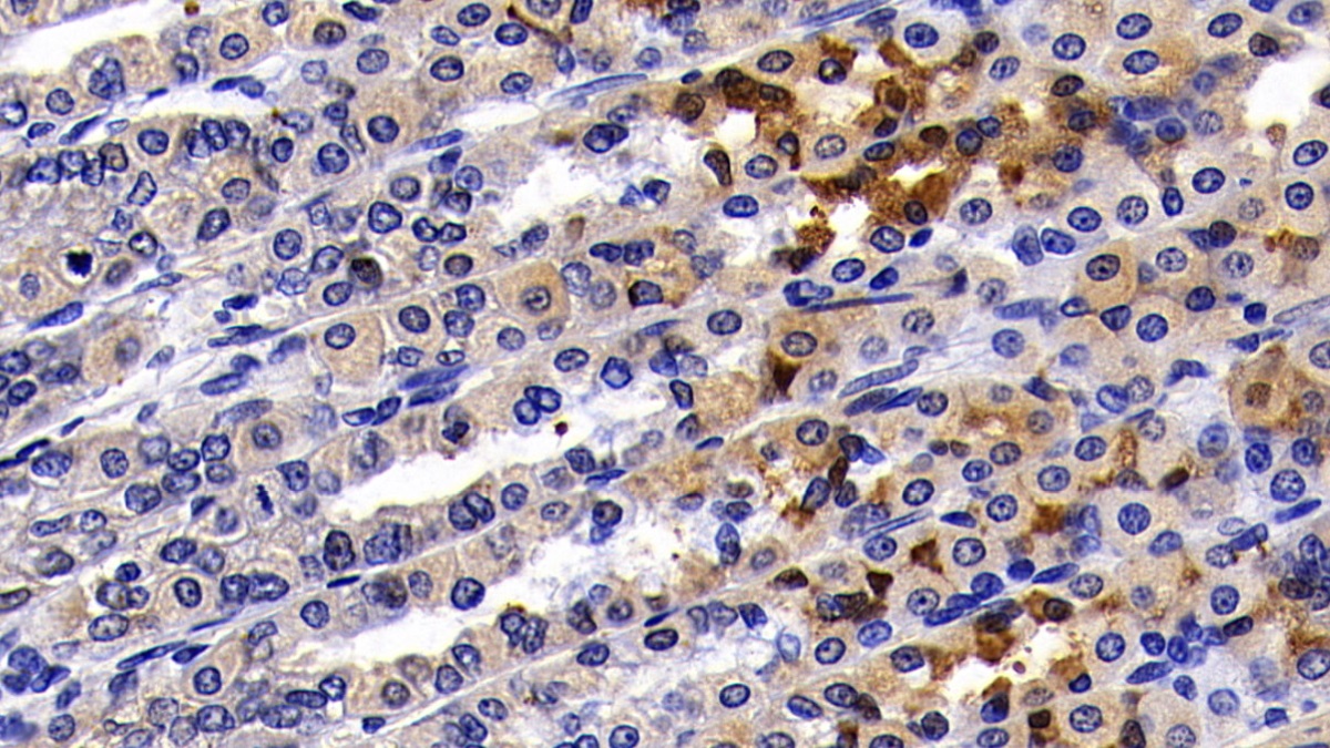 Polyclonal Antibody to Transcription Factor P65 (NFKB3)