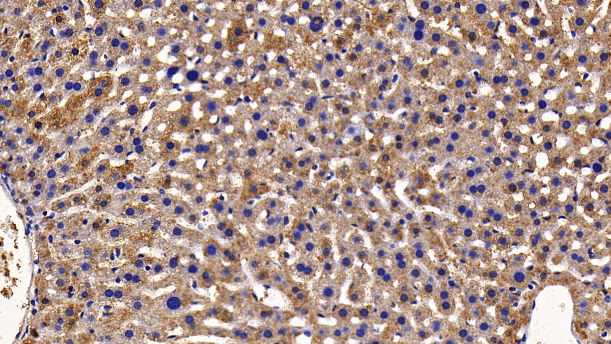 Polyclonal Antibody to Transcription Factor P65 (NFKB3)