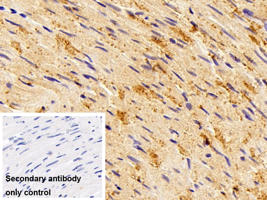 Polyclonal Antibody to Transcription Factor P65 (NFKB3)