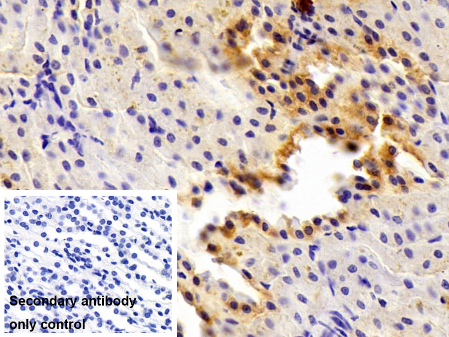 Polyclonal Antibody to Transcription Factor P65 (NFKB3)