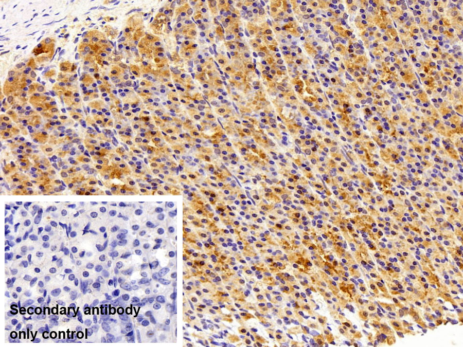 Polyclonal Antibody to Transcription Factor P65 (NFKB3)