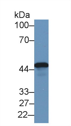 Polyclonal Antibody to Tachykinin Receptor 2 (TACR2)