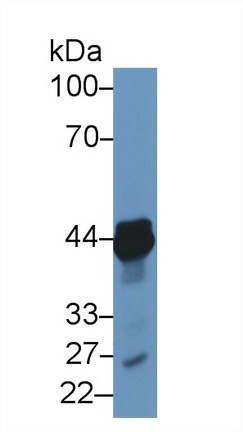 Polyclonal Antibody to Tachykinin Receptor 2 (TACR2)