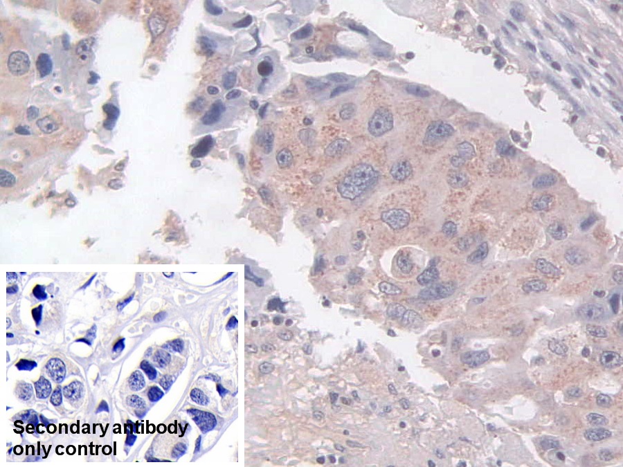 Polyclonal Antibody to Tachykinin Receptor 2 (TACR2)