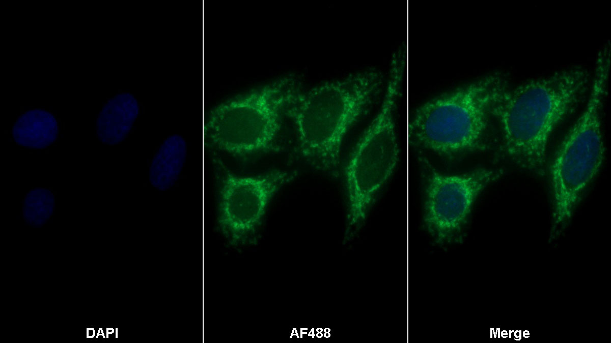 Polyclonal Antibody to Tachykinin Receptor 2 (TACR2)